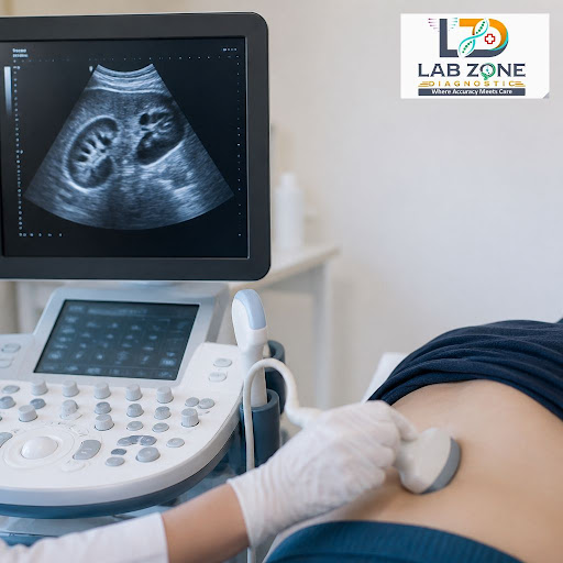 Worried about kidney stone pain or discomfort in your lower back? At Lab Zone Diagnostic in Thane… post image