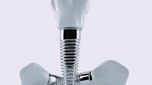 Photo n°3 de Clinique Implant Dentaire Bois Colombes à Bois-Colombes (Cabinet d'implants dentaires)