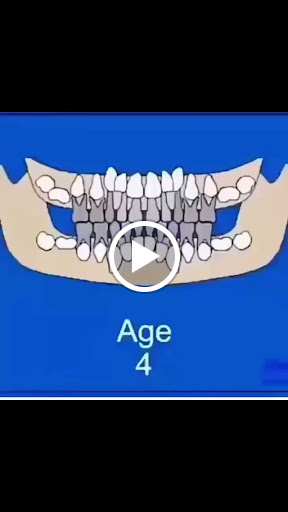 primary teeth post image