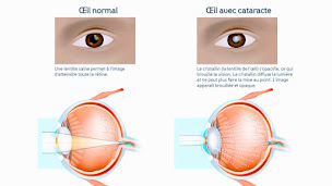 Photo n°16 de Alamé Mahmoud à Charleville-Mézières (Ophtalmologiste)