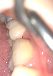 Photo n°3 de Dentiste - Dr Jérome Cayatte à Saint-Denis (Urgences dentaires)