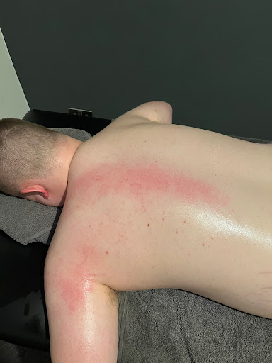 RW Sports Rehabilitation Wirral - Thumbnail