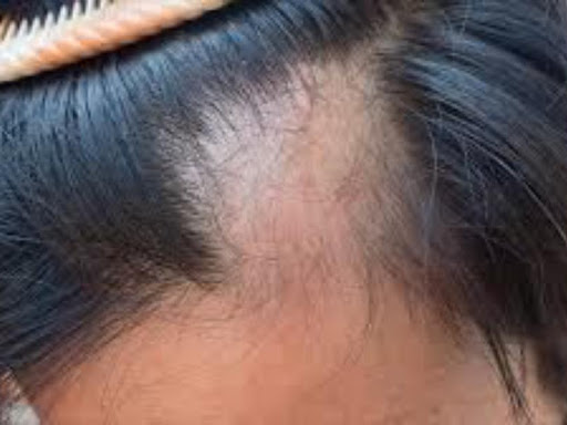 100 RS OFF FIRST CONSULTATION post image
