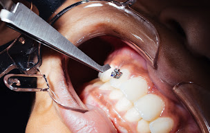 Photo n°9 de Cabinet du Dr Pierre Girod à Pierrelatte (Orthodontiste)