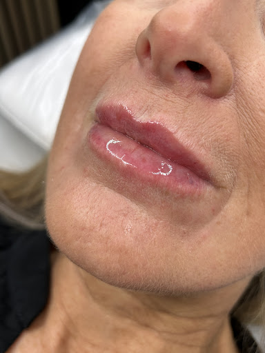 The Aesthetic Company | Botox | Lip Fillers | Skin