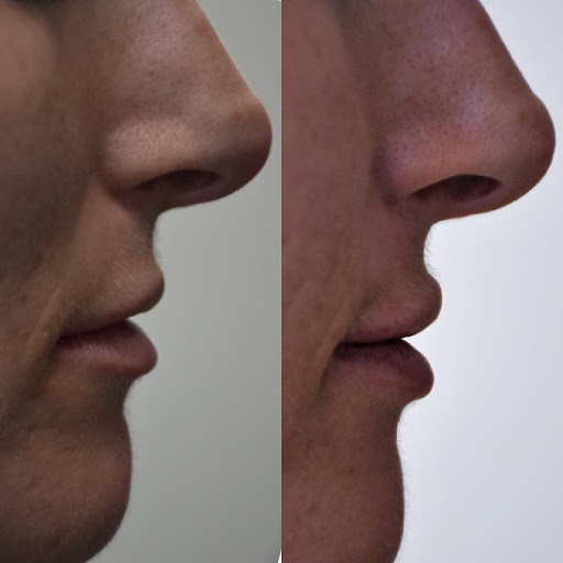 Dr. Sean Weiss - Facial Plastic Surgery
