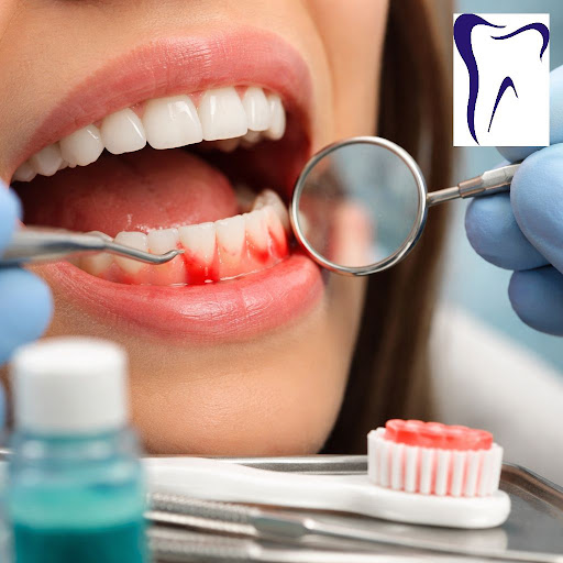 Worried about bleeding gums while brushing or flossing? At Smile Dental Care, Dhole Patil Road, w… post image