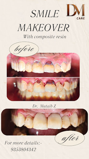 Best Dental care with excellent service post image