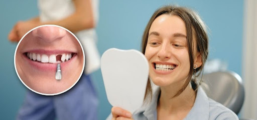 #MissingTeethReplacement #DentalImplants #SmileRestoration #YavatmalDentist #HealthyTeeth #Confid…