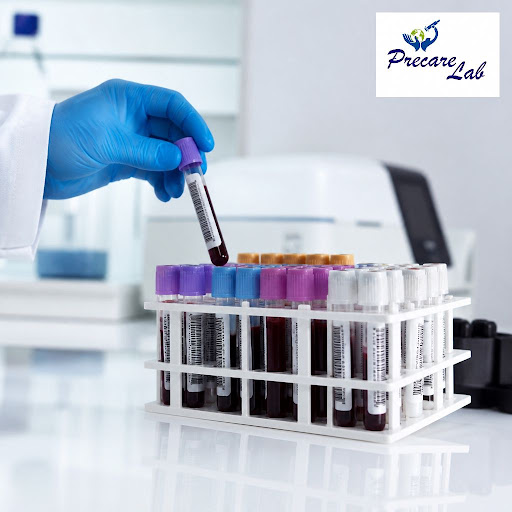 Ever wondered what really happens to your blood or urine sample once it’s collected? At Precare L… post image