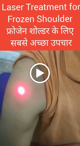 Frozen Shoulder Physiotherapy Treatment with Laser Machine,  post image