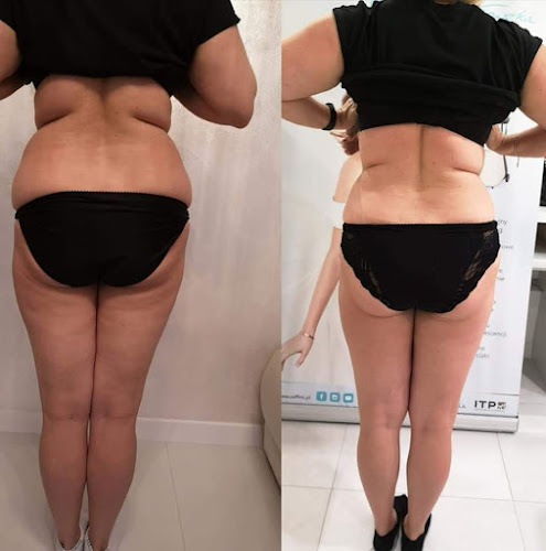 Ekologiczna 11, 65-850 Zielona Góra