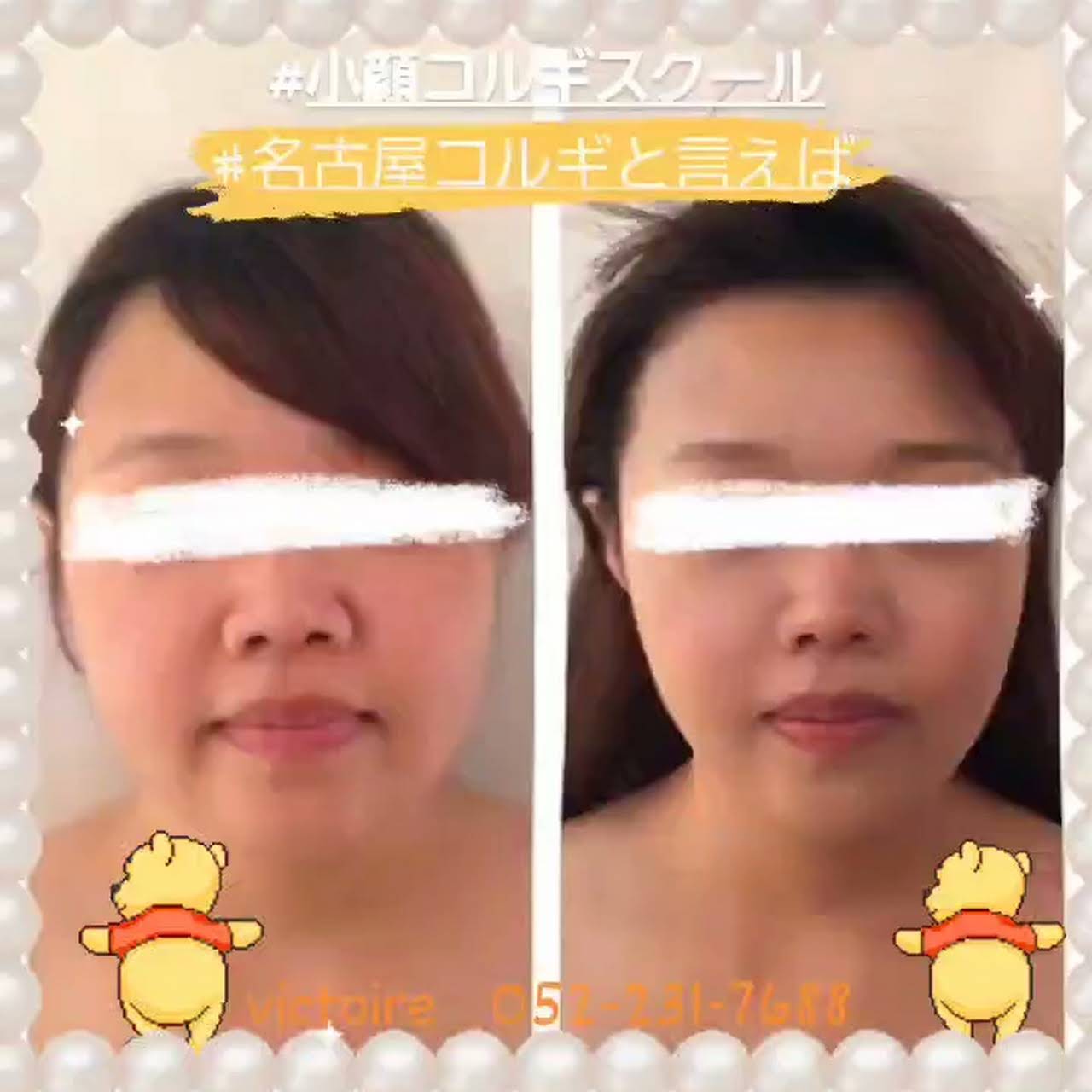 名古屋3d韓国式コルギ ヴィクトワール エステティック サロン