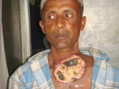 Photos of Cancer home, DR.GM Salam,Best Breast cancer specialist in bangladesh, Rafa .cancer Hospital