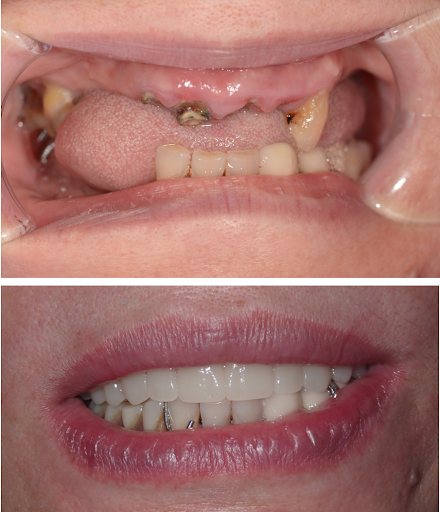 Denta Dental of Hobbs - Thumbnail