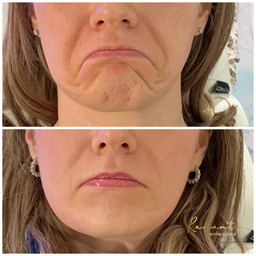 Radiant Med Spa