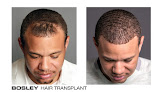 Hair transplant clinic Bosley - Hair Restoration & Transplant - Tampa in Tampa