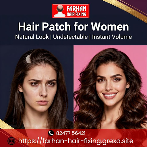 Everything You Need to Know About Hair Patch for Women… post image