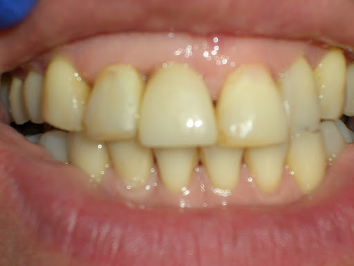 Miami Lakes Cosmetic Dentistry - Thumbnail