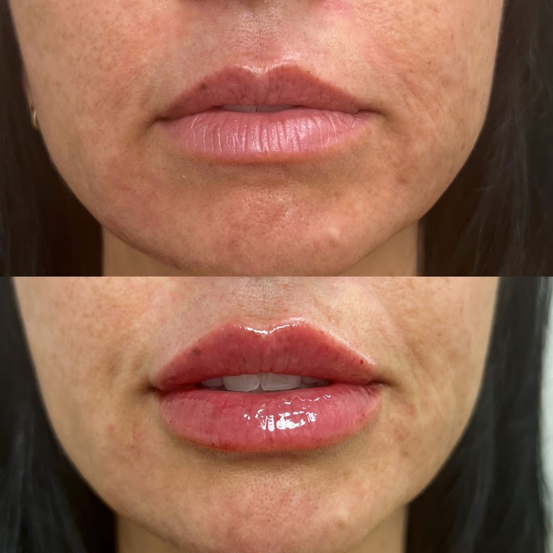 Elixir Aesthetics photo 28