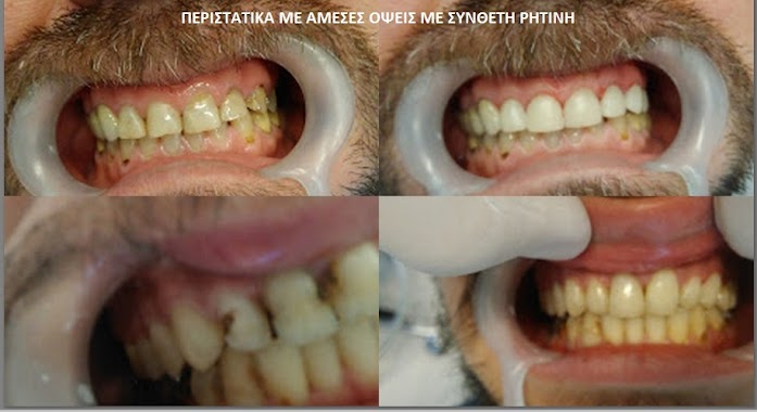 Dental Pantelidis Manolis, Author: Οδοντιατρείο Παντελίδη Μανώλη DDS,DMD, MSc