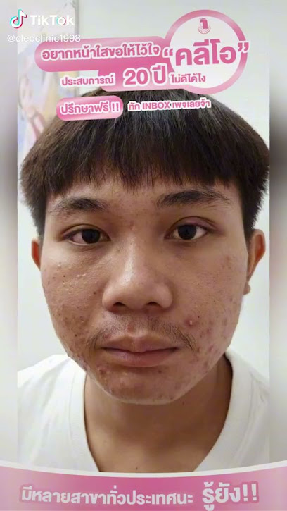 คลีโอ สกิน สิวฝ้ากระ ขอนแก่น Cleo Skin Khon Kaen