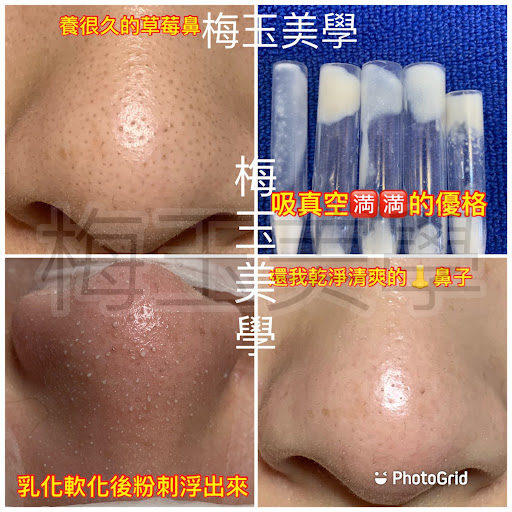 基隆梅玉美學評價、價格、網友推薦資訊 - 無痛清粉刺與臉部護理