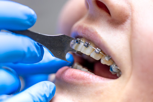 A Healthier, More Confident Smile Starts Here!  post image