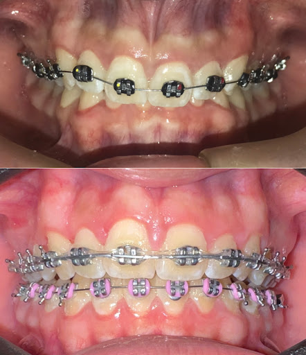 Odontologa Dra Figueredo- ORTODONCIA-ORTOPEDIA FUNCIONAL DE LOS MAXILARES- ODONTOPEDIATRÍA