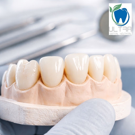 Want your damaged or discoloured tooth to look completely natural again? At Ultra Dental hospital… post image