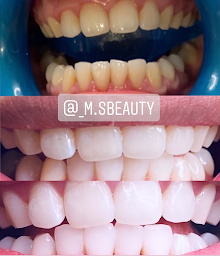 Photo n°1 de M.S Beauty à Annemasse (Service de blanchiment des dents)