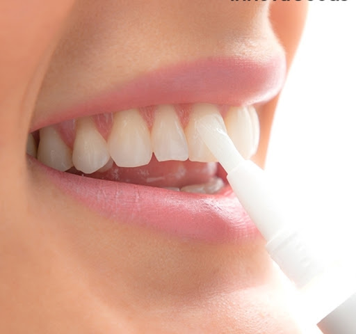 Studio Dentistico Dott. Di Rollo Pierluigi - Thumbnail