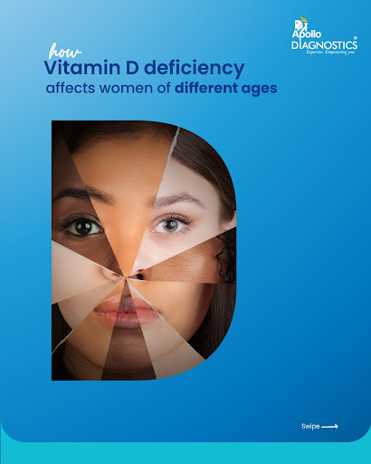 Vitamin D deficiency affects women differently at every age!  Know the symptoms, stay ahead of yo… post image
