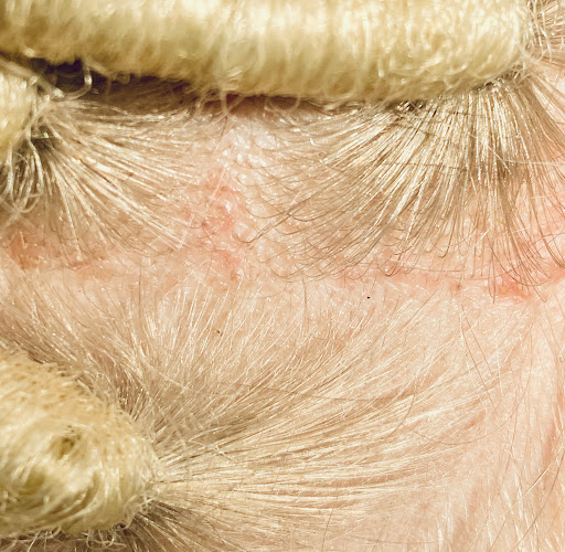 Legacy braids - Thumbnail