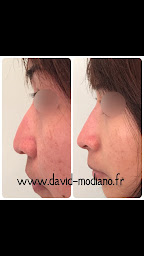 Photo n°13 de Dr David Modiano - Médecine esthétique à Paris à Paris (Médecin)