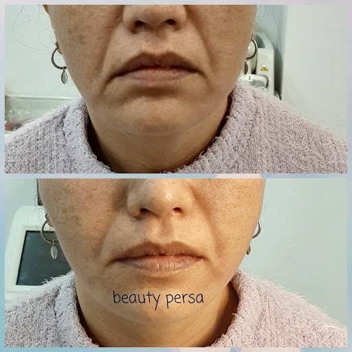 Beauty Persa - Thumbnail
