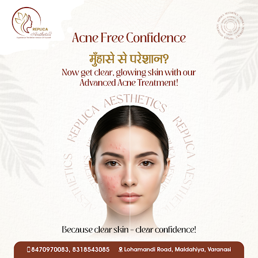 “Acne isn’t permanent… but your confidence should be!” ✨ post image