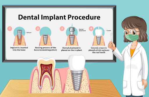 Reconstruction of Tooth Structure for Restored Function and Smile post image