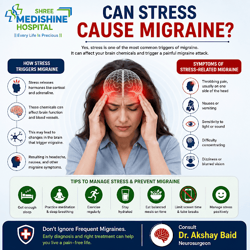 Can Stress Cause Migraine? post image