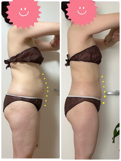 超音波エステサロン mariposa