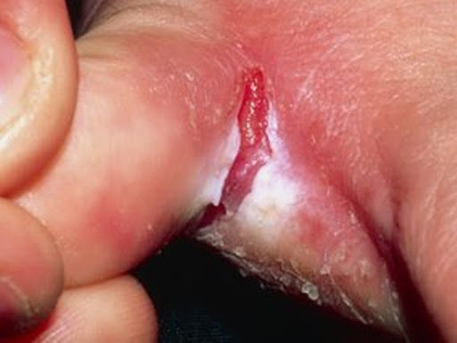 ATHLET FOOT  post image