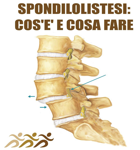 Studio di Terapia Manuale, Osteopatia e Fisioterapia Dott. Sirna Giancarlo - Thumbnail