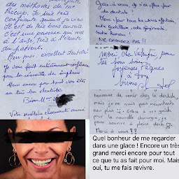 Photo n°10 de Dr. Precup Valentin à Dijon (Prosthodontiste)