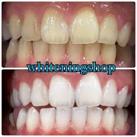 ホワイトニングショップ八代店