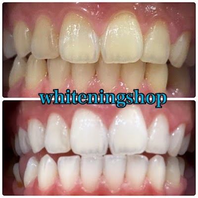 ホワイトニングショップ八代店