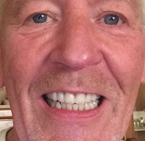 Dentale - Visual