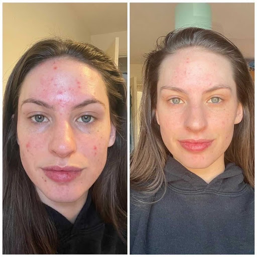 All About Skin Studio Ltd - Thumbnail