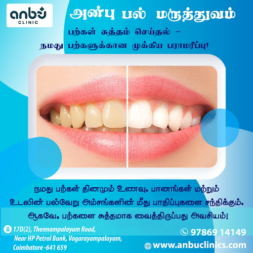 🦷✨ பற்கள் சுத்தம் செய்தல் – நமது பற்களுக்கான முக்கிய பராமரிப்பு! post image