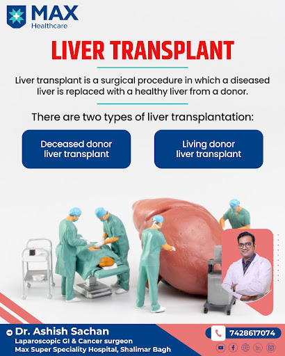 "#Livertransplant is a life-saving surgery where a damaged liver is replaced with a healthy one.… post image