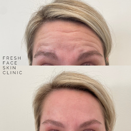 Fresh Face Skin Clinic